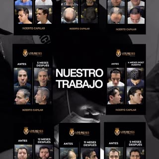 Nuestro trabajo: 🦁🔥

Detrás de cada uno de estos casos hay una planificación precisa, un diseño pe