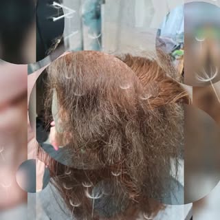 Here's a sneak peek into a hair replacement system? 
This is considered a hair integration system.  