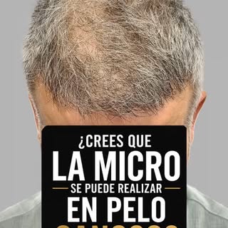 El pelo canoso no era el problema.

El problema era resignarse a ver cada vez más cuero cabelludo en