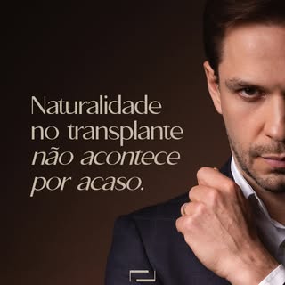 Naturalidade não é sorte, é estratégia.

Planejamento, proporção e leitura do padrão de queda e da d
