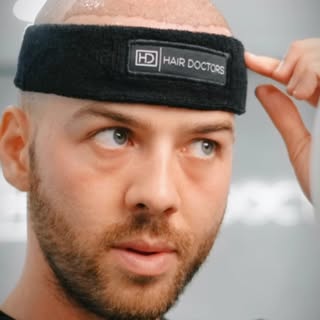 THE HAIR TRANSPLANT PROCEDURE, 
STEP-BY-STEP🧵

▪️CONSULTATION — We assess suitability and talk thro