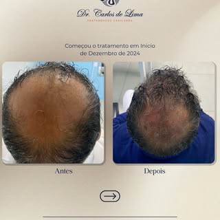 ✨ Resultado que fala por si!
Com acompanhamento médico e tratamento personalizado, é possível recupe