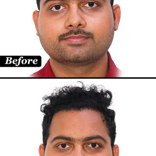 Hair loss changes more than your appearance—it can change how you feel about yourself.

This transfo