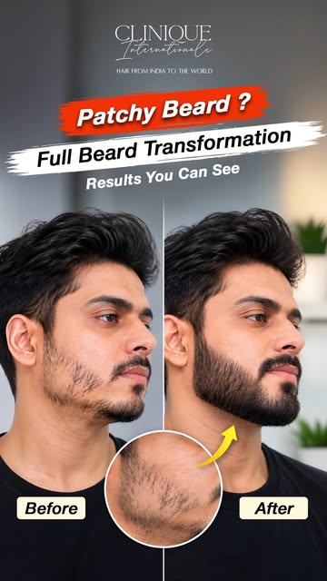 A fuller beard can change more than your look—it can bring back the confidence you’ve been missing. 