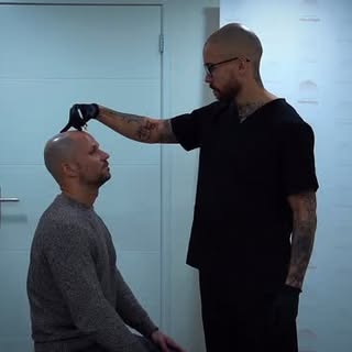 #scalptattoo #scalpmicropigmentation #hairlinetattoo #baldingsolution #smp