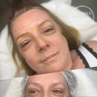 Fresh Brows ✍🏻

Much overdue Annual top up! Her old brows were done around 2.5 years ago-We bought 