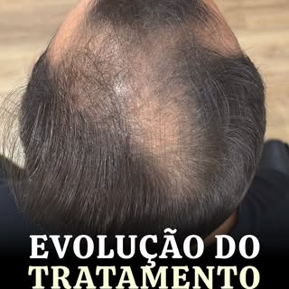 Seguuura que lá vem pedrada! O que foi esse resultado, minha gente!?!? O que não faz um tratamento p