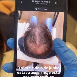 2 sessões regenerativas separam esse resultado! E ainda temos chão pela frente! Mais um que tomou a 
