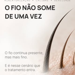Na calvície, tanto masculina quanto feminina, os fios não caem aos montes. Eles vão afinando.

Mas, 