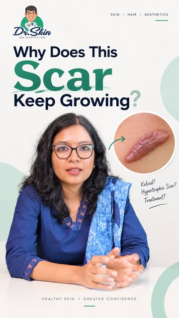 ⚠️That raised scar may be more than just a scar.

Keloids are thick, raised scars that develop when 