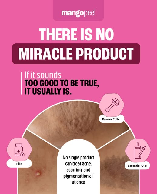 There’s No “Miracle Product” for Acne

A product promising to clear acne, erase scars, and fade pigm