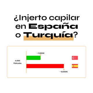Tanto Madrid como Turquía tienen ventajas y desventajas únicas en cuanto a la elección de un destino
