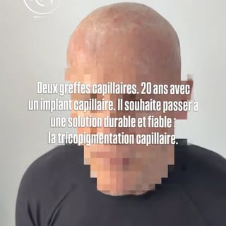 Parfois, le plus beau changement ne se voit pas seulement sur la tête.

Il se voit dans la façon de 