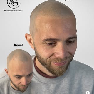 Un choix fort. Une nouvelle liberté.

Kevin a fait 8 heures de route à chacune de ses 3 sessions pou