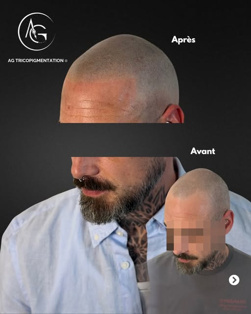 🪄 Un avant / après effet rasé : une transformation complète, tout en conservant un résultat naturel