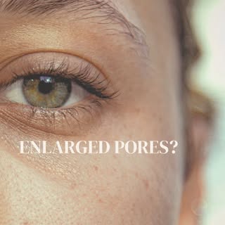 Say goodbye to enlarged pores and uneven texture.

Microneedling works beneath the surface to stimul