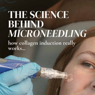 Healthy skin starts from within. Microneedling works by supporting your skin's natural renewal proce
