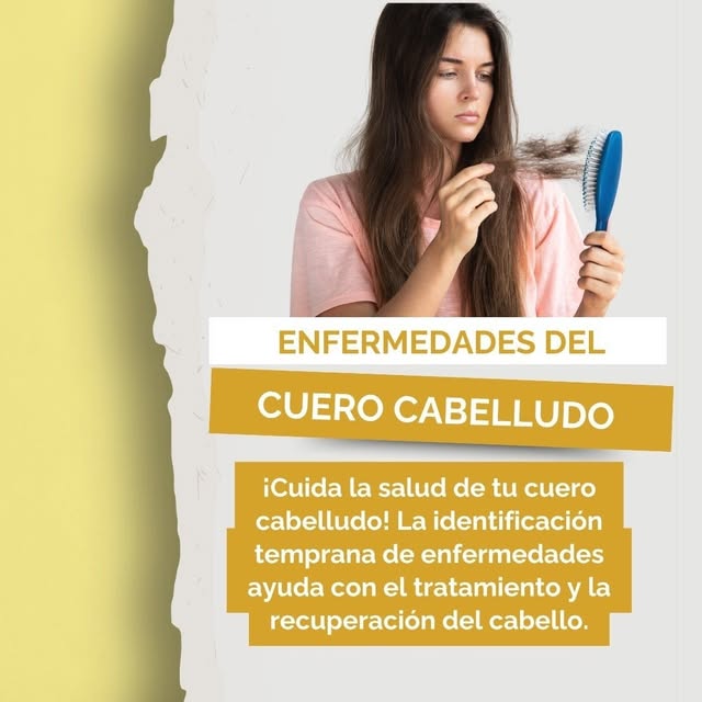 🚨 ¡Atención! Si sientes picazón, enrojecimiento o descamación en tu cuero cabelludo, ¡esto es para 