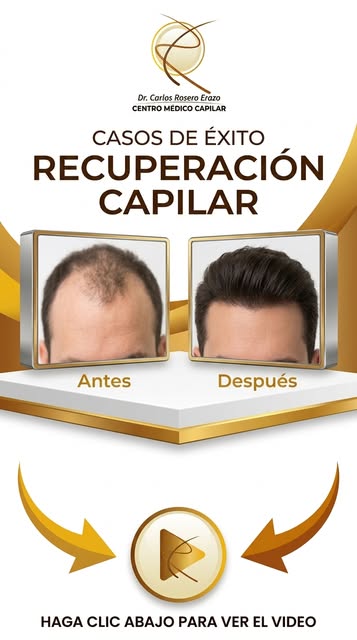 ¿𝐍𝐨𝐭𝐚𝐬 𝐪𝐮𝐞 𝐭𝐮 𝐜𝐚𝐛𝐞𝐥𝐥𝐨 𝐩𝐢𝐞𝐫𝐝𝐞 𝐝𝐞𝐧𝐬𝐢𝐝𝐚𝐝 𝐲 𝐧𝐨 𝐬𝐚𝐛𝐞𝐬 𝐩𝐨𝐫 𝐝𝐨́