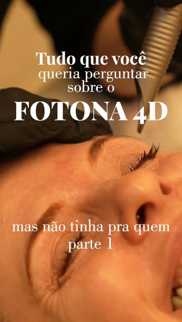 O Fotona é o laser conhecido como a “Ferrari dos lasers”, exatamente porque sua tecnologia está entr