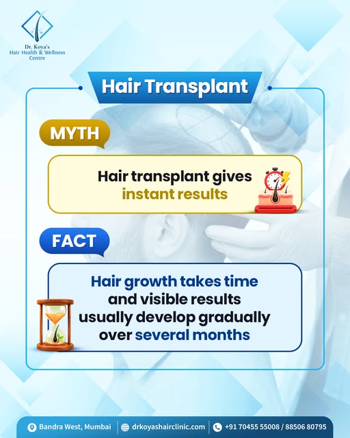 Myth ❌ Instant results
Fact ✅ Gradual growth

A hair transplant is not an overnight transformation. 