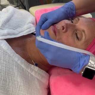 🔊Microdermabrasion at The Hormone Connection - This non-invasive procedure rejuvenates the skin by 