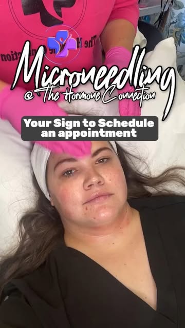 ✨ Skincare Procedure🩺  Microneedling at The Hormone Connection 📖 Microneedling Facial
Do you strug
