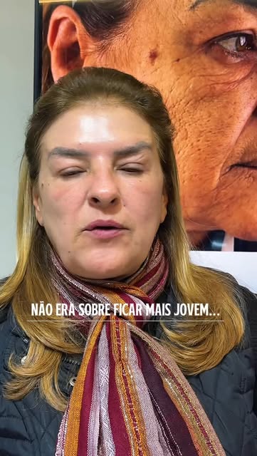 Paciente submetida ao BioLifting Regenerativo Facial.

Resultado após 4 meses, com melhora das rugas