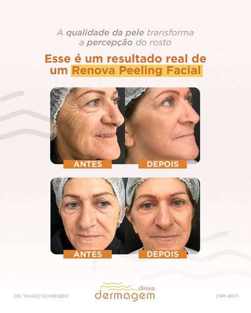 Cada pele envelhece de uma maneira. Por isso, cada tratamento também deve ser individualizado.

Nest