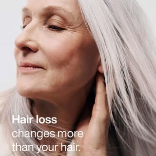 Hair loss is rarely traced to a single, isolated cause. Genetics, illness, stress, pregnancy, hormon