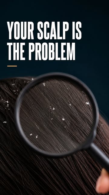 Most people spend weeks researching laser caps, LED devices, and hair growth technology.

Almost nob