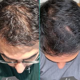 This time it’s personal: Dr Farmah’s results

A little while ago, Dr Farmah shared his personal expe