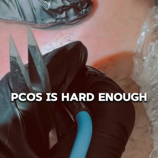 PCOS is hard enough. Unwanted facial hair shouldn’t make it harder. 🤍
For many women with PCOS, the