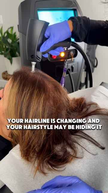 Sometimes your hairstyle can hide the first signs that your hair is changing. 👀
Maybe your temples 