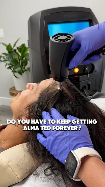 Do you have to keep getting Alma TED forever? Not necessarily. 🤍

Hair restoration is different for