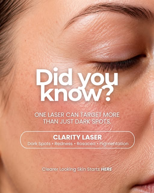 Did you know your redness, dark spots and uneven pigmentation may be able to be treated with the sam