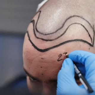 Jeder Schritt im Prozess wird mit höchster Sorgfalt durchgeführt, um ein natürliches und harmonische