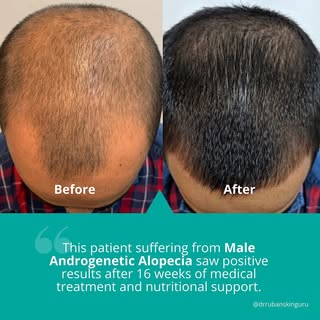 This patient saw positive results after a change in diet and going on a prescribed medical regimen c