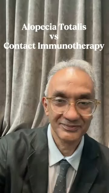 Alopecia Totalis treated with contact immunotherapy
100% success rate
Results are particularly well 