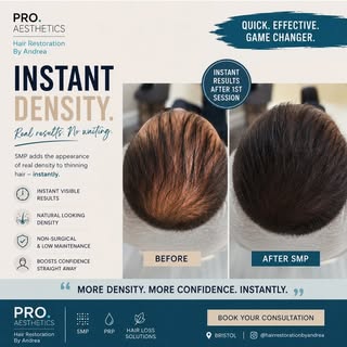 Hair looks thicker. Confidence feels bigger.

No fibres.
No surgery.
No waiting months.

Just natura