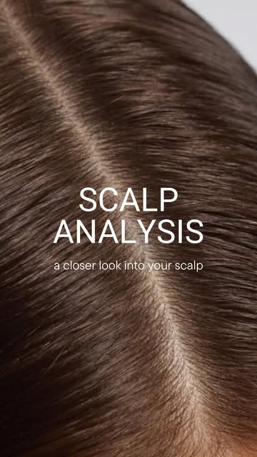 Scalp analysis is the first step to understanding your hair loss. 🔍

We broke  down what a professi