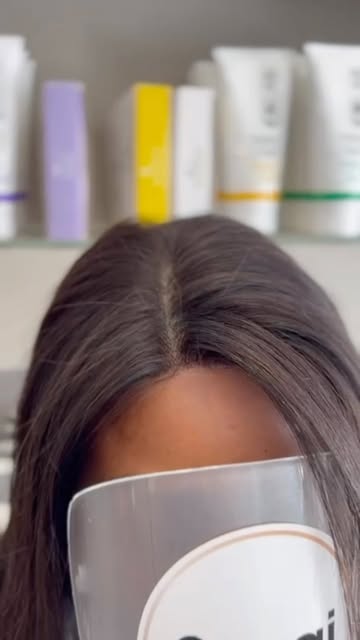 A natural hairline makes all the difference.

A bespoke hair replacement system should look and feel