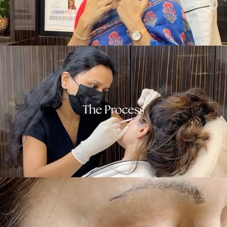 Expert Hands. Precise Process. Visible Results.✨
#ethoski #glowingskin #botox #explorepage