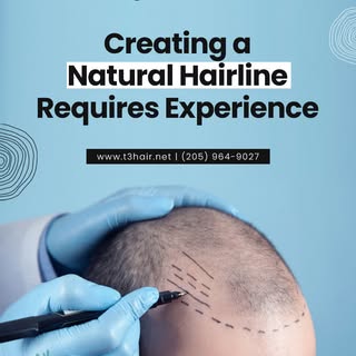 Designing a natural hairline requires precision, artistry, and medical expertise.

At T3 Hair Preser