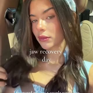 Massager neurotoxin can have many indications. Thanks for sharing @jessicamarvisi. Wishing you a spe