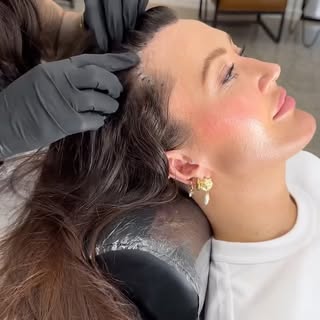 Hairline thickening for women ✨💕

Using scalp micropigmentation tattoo. 

Adding the tattoo to your