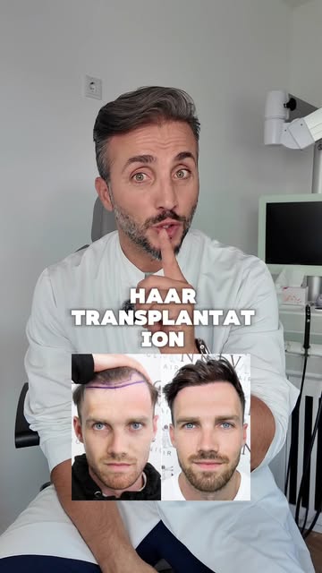 **Wie viele Grafts braucht eine erfolgreiche Haartransplantation wirklich? 👨‍⚕️**

In diesem Video 