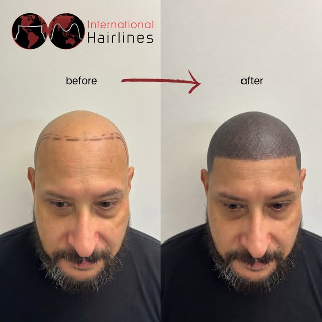 WAIT… WHAT?! 😭💀

We know what you’re thinking…
“THAT’S the after?!” 👀

Before you come for us 😂 