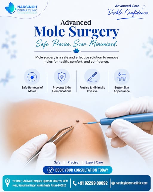 ✨ अनचाहे तिल और मस्सों से पाएं सुरक्षित और बेदाग छुटकारा — Advanced Mole Surgery! 🌿🔬

Safe. Precis