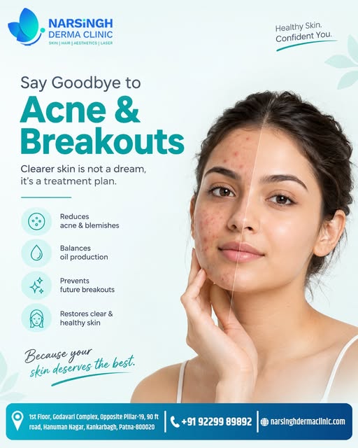 Say Goodbye to Acne & Breakouts! 🌸✨

पिंपल्स, दाग-धब्बे और ऑयली स्किन से आपका कॉन्फिडेंस कम हो रहा 